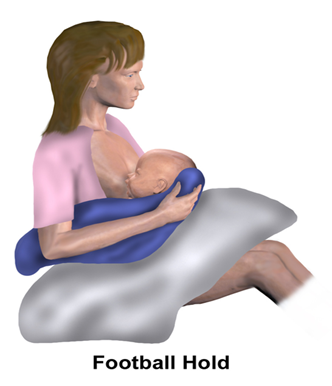 هل تؤثر الولادة القيصرية على الرضاعة الطبيعية - وضع الكرة
